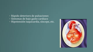 • Rápido deterioro de pulsaciones
• Síntomas de bajo gasto cardiaco
• Hipotensión taquicardia, síncope, etc.
 