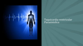 Taquicardia ventricular
Parasistolica
 