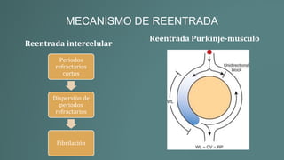 MECANISMO DE REENTRADA
Reentrada intercelular
Reentrada Purkinje-musculo
Periodos
refractarios
cortos
Dispersión de
periodos
refractarios
Fibrilación
 