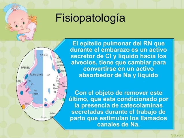 Taquipnea transitoria del recien nacido