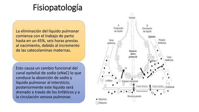 Taquipnea transitoria del recién nacido | PPT