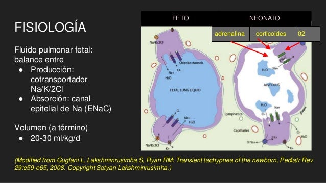 Taquipnea transitoria del recién nacido (ttrn)