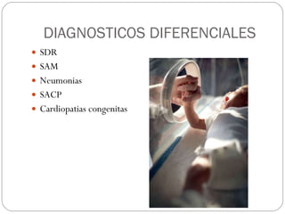 DIAGNOSTICOS DIFERENCIALES SDR SAM Neumonias SACP Cardiopatias congenitas 