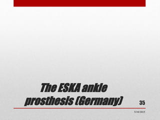 The ESKA ankle
prosthesis (Germany) 35
5/10/2015
 