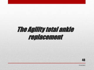 The Agility total ankle
replacement
48
5/10/2015
 
