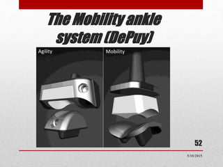 The Mobility ankle
system (DePuy)
52
5/10/2015
 