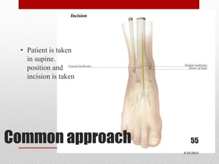 Common approach
5/10/2015
55
• Patient is taken
in supine.
position and
incision is taken
 