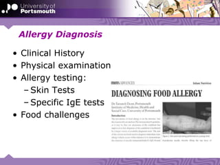 Allergy Diagnosis
• Clinical History
• Physical examination
• Allergy testing:
– Skin Tests
– Specific IgE tests
• Food challenges
 