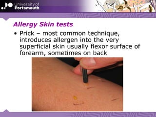 Allergy Skin tests
• Prick – most common technique,
introduces allergen into the very
superficial skin usually flexor surface of
forearm, sometimes on back
 