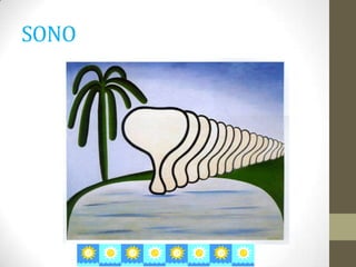 SONO
 