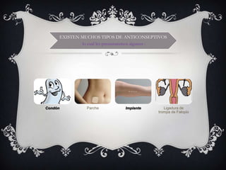 EXISTEN MUCHOS TIPOS DE ANTICONSEPTIVOS
                 lo cual les presentaremos algunos :




Condón             Parche          Implante        Ligadura de
                                                trompa de Falopio
 