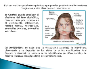 Existen muchos productos químicos que pueden producir malformaciones
congénitas, entre ellos pueden mencionarse:
a) Alcohol: puede producir el
síndrome del feto alcohólico,
caracterizado por retardo en
el crecimiento intrauterino,
retardo mental, microcefalia,
anomalías oculares, anomalías
articulares.
(b) Antibióticos: se sabe que la tetraciclina atraviesa la membrana
placentaria y se deposita en los sitios de activa calcificación fetal
(huesos y dientes). La sordera se ha identificado en niños nacidos de
madres tratadas con altas dosis de estreptomicina.
 