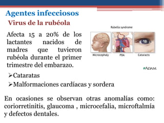 Agentes infecciosos
Virus de la rubéola
Afecta 15 a 20% de los
lactantes nacidos de
madres que tuvieron
rubéola durante el primer
trimestre del embarazo.
En ocasiones se observan otras anomalías como:
coriorretinitis, glaucoma , microcefalia, microftalmía
y defectos dentales.
Cataratas
Malformaciones cardíacas y sordera
 