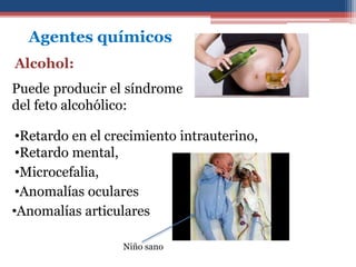 Agentes químicos
Alcohol:
Puede producir el síndrome
del feto alcohólico:
•Retardo en el crecimiento intrauterino,
•Retardo mental,
•Microcefalia,
•Anomalías oculares
•Anomalías articulares
Niño sano
 