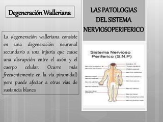Degeneración Walleriana LAS PATOLOGIAS 
La degeneración walleriana consiste 
en una degeneración neuronal 
secundario a una injuria que cause 
una disrupción entre el axón y el 
cuerpo celular. Ocurre más 
frecuentemente en la vía piramidal 
pero puede afectar a otras vías de 
sustancia blanca 
DEL SISTEMA 
NERVIOSO PERIFERICO 
 
