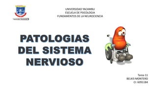 UNIVERSIDAD YACAMBU
ESCUELA DE PSICOLOGIA
FUNDAMENTOS DE LA NEUROCIENCIA

Tarea 11
BELKIS MONTERO
CI: 6091184

 
