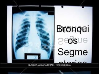 Bronquios Segmentarios CLAUDIA MAGAÑA ORIAS -  KINESIOLOGÍA 