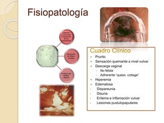 Fisiopatología 
Cuadro Clínico 
 Prurito 
 Sensación quemante a nivel vulvar 
 Descarga vaginal 
◦ No fétida 
◦ Adherente “queso cottage” 
 Hiperemia 
 Edematosa 
• Dispareunia 
• Disuria 
• Eritema e inflamación vulvar 
• Lesiones pustulopapulares 
 