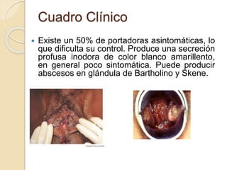 Cuadro Clínico 
 Existe un 50% de portadoras asintomáticas, lo 
que dificulta su control. Produce una secreción 
profusa inodora de color blanco amarillento, 
en general poco sintomática. Puede producir 
abscesos en glándula de Bartholino y Skene. 
 