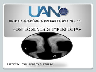 UNIDAD ACADÉMICA PREPARATORIA NO. 11
«OSTEOGENESIS IMPERFECTA»
PRESENTA: ESAU TORRES GUERRERO
 