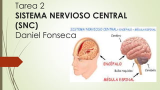 Tarea 2
SISTEMA NERVIOSO CENTRAL
(SNC)
Daniel Fonseca
 
