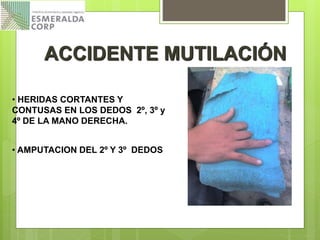 • AMPUTACION DEL 2º Y 3º DEDOS
• HERIDAS CORTANTES Y
CONTUSAS EN LOS DEDOS 2º, 3º y
4º DE LA MANO DERECHA.
ACCIDENTE MUTILACIÓN
 