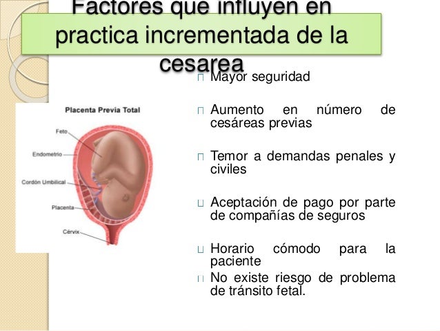 Tarea33 jimr cesarea Tarea33 jimr cesarea