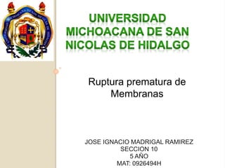 Ruptura prematura de 
Membranas 
JOSE IGNACIO MADRIGAL RAMIREZ 
SECCION 10 
5 AÑO 
MAT: 0926494H 
 