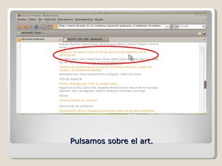 Pulsamos sobre el art. 