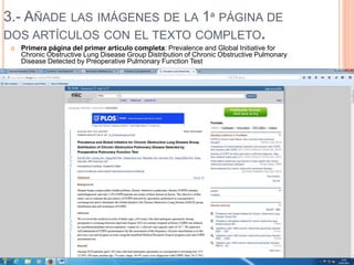 3.- AÑADE LAS IMÁGENES DE LA 1ª PÁGINA DE
DOS ARTÍCULOS CON EL TEXTO COMPLETO.
 Primera página del primer artículo completa: Prevalence and Global Initiative for
Chronic Obstructive Lung Disease Group Distribution of Chronic Obstructive Pulmonary
Disease Detected by Preoperative Pulmonary Function Test
 