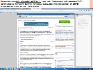 PRIMERA PÁGINA DEL SEGUNDO ARTÍCULO COMPLETA: “CONTINUING TO CONFRONT COPD
INTERNATIONAL PHYSICIAN SURVEY: PHYSICIAN KNOWLEDGE AND APPLICATION OF COPD
MANAGEMENT GUIDELINES IN 12 COUNTRIES
 