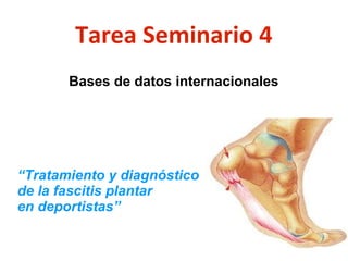 Tarea Seminario 4
Bases de datos internacionales

“Tratamiento y diagnóstico
de la fascitis plantar
en deportistas”

 