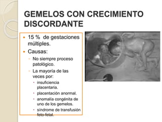 GEMELOS CON CRECIMIENTO 
DISCORDANTE 
 15 % de gestaciones 
múltiples. 
 Causas: 
◦ No siempre proceso 
patológico. 
◦ La mayoría de las 
veces por: 
 insuficiencia 
placentaria. 
 placentación anormal. 
 anomalía congénita de 
uno de los gemelos. 
 síndrome de transfusión 
feto-fetal. 
 