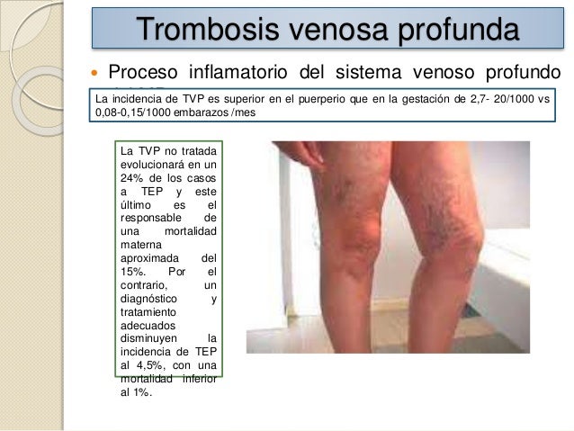 La clínica de la cirugía vascular 2