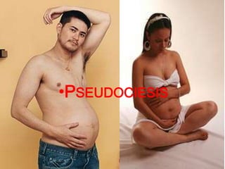 •PSEUDOCIESIS 
 