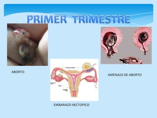ABORTO
AMENAZA DE ABORTO
EMBARAZO HECTOPICO
 