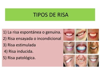 TIPOS DE RISA
1) La risa espontánea o genuina.
2) Risa ensayada o incondicional
3) Risa estimulada
4) Risa inducida.
5) Risa patológica.
 