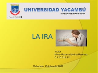 Autor
Marly Roxana Molina Ramírez
C.I 20.518.311
Cabudare, Octubre de 2017
 