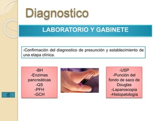 Diagnostico 
LABORATORIO Y GABINETE 
-Confirmación del diagnostico de presunción y establecimiento de 
una etapa clínica. 
-BH 
-Enzimas 
pancreáticas 
-QS 
-PFH 
-GCH 
-USP 
-Punción del 
fondo de saco de 
Douglas 
-Laparoscopia 
-Histopatología 
 