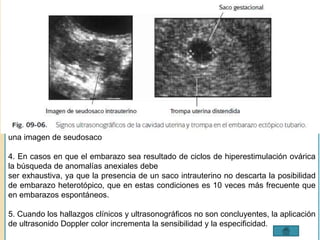 1. La visualización de un saco intrauterino con saco vitelino o si éste excluye la 
posibilidad de embarazo ectópico. 
2. El ultrasonido transvaginal en embarazos tempranos tiene mayor sensibilidad y 
especificidad que el transabdominal. 
3. La pérdida sanguínea intracavitaria que ocurre en el embarazo tubario puede crear 
una imagen de seudosaco 
4. En casos en que el embarazo sea resultado de ciclos de hiperestimulación ovárica 
la búsqueda de anomalías anexiales debe 
ser exhaustiva, ya que la presencia de un saco intrauterino no descarta la posibilidad 
de embarazo heterotópico, que en estas condiciones es 10 veces más frecuente que 
en embarazos espontáneos. 
5. Cuando los hallazgos clínicos y ultrasonográficos no son concluyentes, la aplicación 
de ultrasonido Doppler color incrementa la sensibilidad y la especificidad. 
 