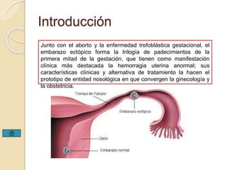 Introducción 
Junto con el aborto y la enfermedad trofoblástica gestacional, el 
embarazo ectópico forma la trilogía de padecimientos de la 
primera mitad de la gestación, que tienen como manifestación 
clínica más destacada la hemorragia uterina anormal; sus 
características clínicas y alternativa de tratamiento la hacen el 
prototipo de entidad nosológica en que convergen la ginecología y 
la obstetricia. 
 