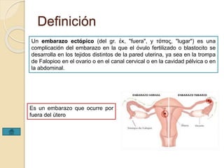 Definición 
Un embarazo ectópico (del gr. ἐκ, "fuera", y τόπος, "lugar") es una 
complicación del embarazo en la que el óvulo fertilizado o blastocito se 
desarrolla en los tejidos distintos de la pared uterina, ya sea en la trompa 
de Falopioo en el ovario o en el canal cervical o en la cavidad pélvica o en 
la abdominal. 
Es un embarazo que ocurre por 
fuera del útero 
 