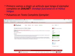 • Primero vamos a elegir un artículo que tenga el ejemplar
completo en DIALNET: Vendaje funcional en el Hallux
Valgus
• Pulsamos en Texto Completo Ejemplar:
 