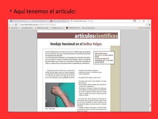 • Aquí tenemos el artículo:
 