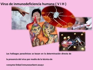 Virus de inmunodeficiencia humana ( V I H )
Los hallazgos paraclínicos se basan en la determinación directa de
la presencia del virus por medio de la técnica de
«enzyme-linked inmunosorbent assay»
 