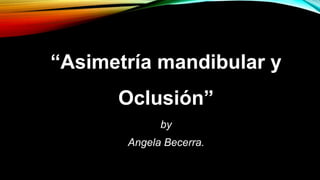 “Asimetría mandibular y
Oclusión”
by
Angela Becerra.
 