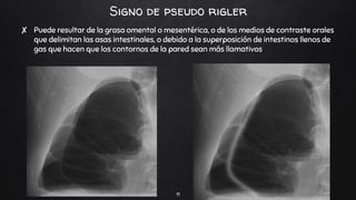 Sdinal De Rigler TAREA NEUMOBILIA NEUMATOSIS PROTAL RIGLER.pptx