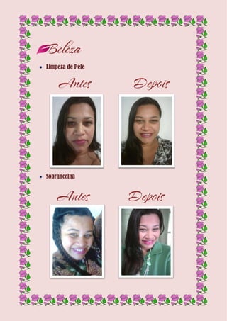 Beleza
 Limpeza de Pele
Antes Depois
 Sobrancelha
Antes Depois
 