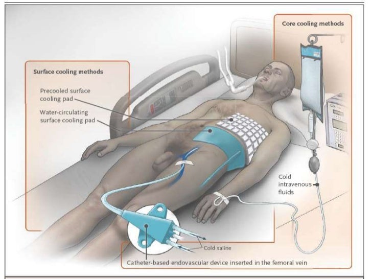 catheter care