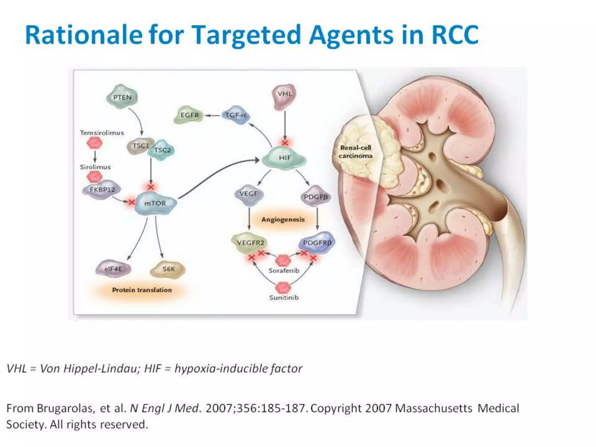 Targeted therapy for metastatic renal cell carcinoma | PDF